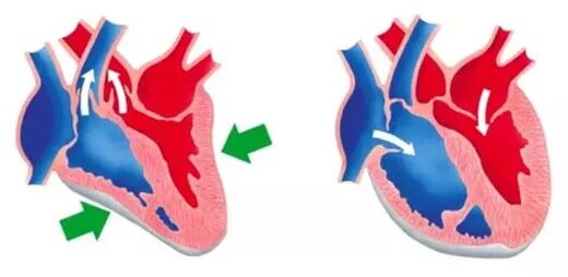 Blutforde normalizes the functioning of the heart and blood vessels